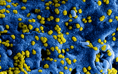 EDventure en coronavirus