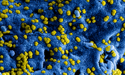 EDventure en coronavirus