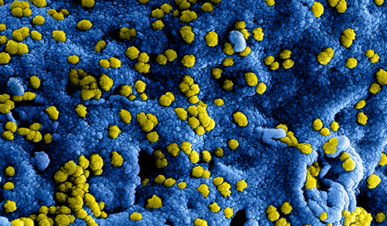 EDventure en coronavirus